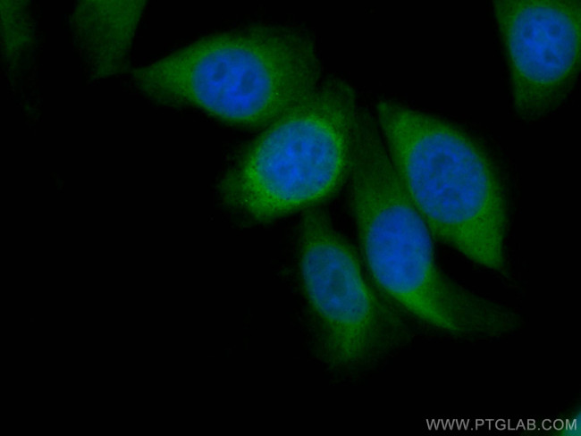 ENO1 Antibody in Immunocytochemistry (ICC/IF)