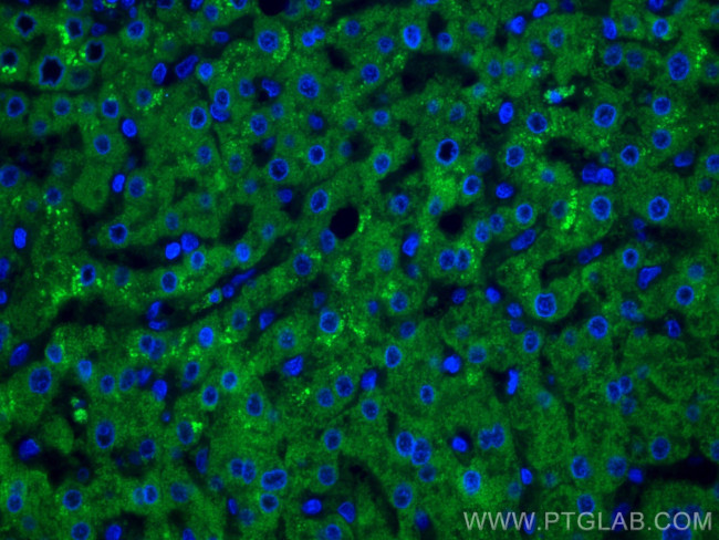 GCK Antibody in Immunohistochemistry (Paraffin) (IHC (P))