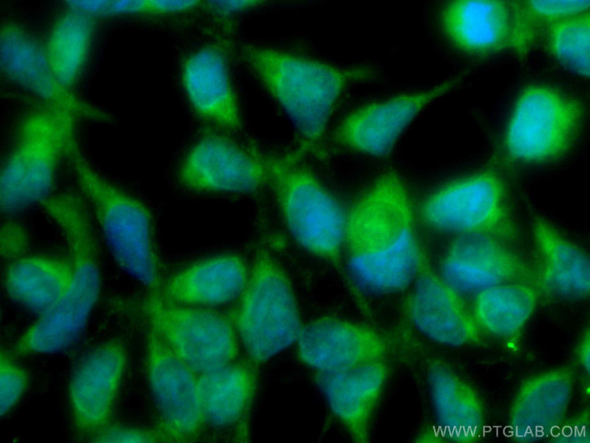 VAMP4 Antibody in Immunocytochemistry (ICC/IF)