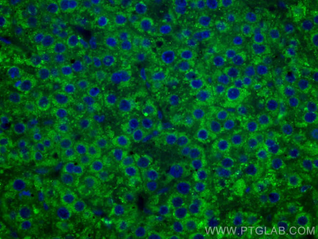 FUCA1 Antibody in Immunohistochemistry (Paraffin) (IHC (P))