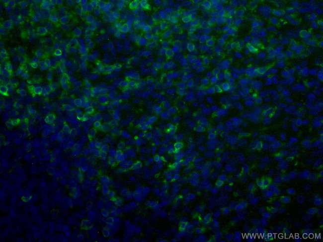 CD5 Antibody in Immunohistochemistry (Paraffin) (IHC (P))