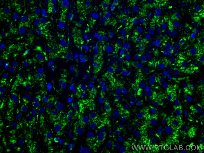 CD107a/LAMP1 Antibody in Immunohistochemistry (Paraffin) (IHC (P))
