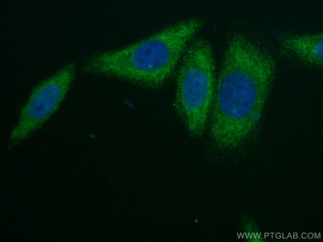 Alpha 2-Antiplasmin Antibody in Immunocytochemistry (ICC/IF)