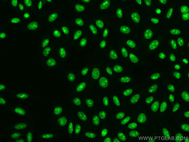 SSRP1 Antibody in Immunocytochemistry (ICC/IF)