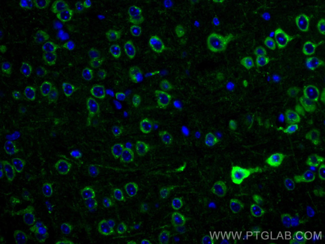 Alpha SNAP Antibody in Immunohistochemistry (Paraffin) (IHC (P))