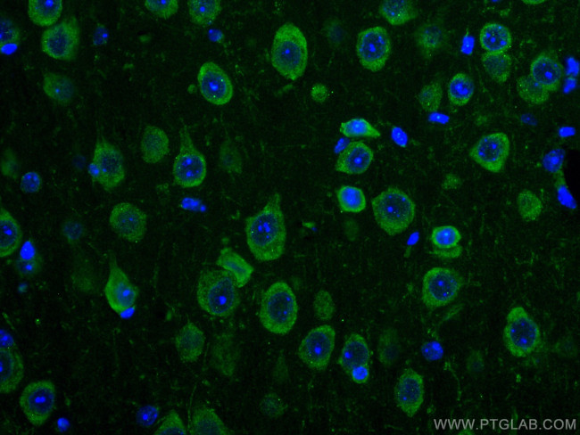 TRIM2 Antibody in Immunohistochemistry (Paraffin) (IHC (P))