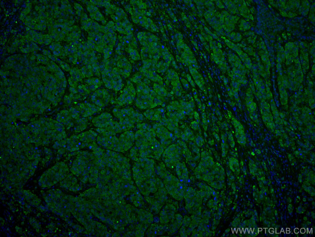 ANAPC5 Antibody in Immunohistochemistry (Paraffin) (IHC (P))