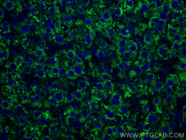 PPP4R1 Antibody in Immunohistochemistry (Paraffin) (IHC (P))