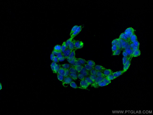 MESDC2 Antibody in Immunocytochemistry (ICC/IF)
