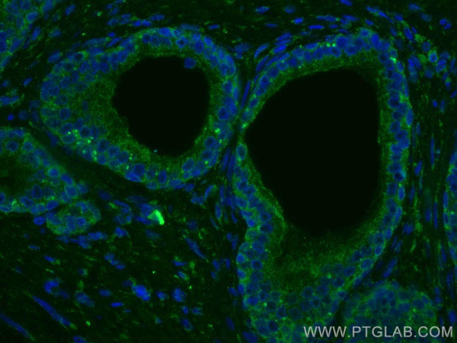 TAOK3 Antibody in Immunohistochemistry (Paraffin) (IHC (P))