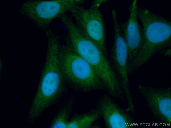 MGMT Antibody in Immunocytochemistry (ICC/IF)