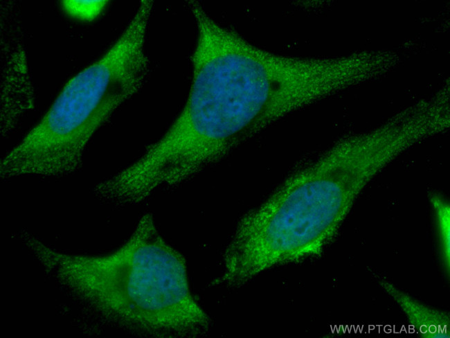 CMPK1 Antibody in Immunocytochemistry (ICC/IF)
