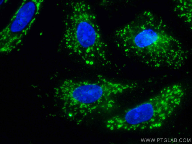 FES Antibody in Immunocytochemistry (ICC/IF)