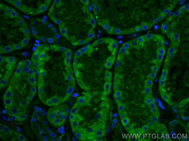 SLC2A9 Antibody in Immunohistochemistry (Paraffin) (IHC (P))