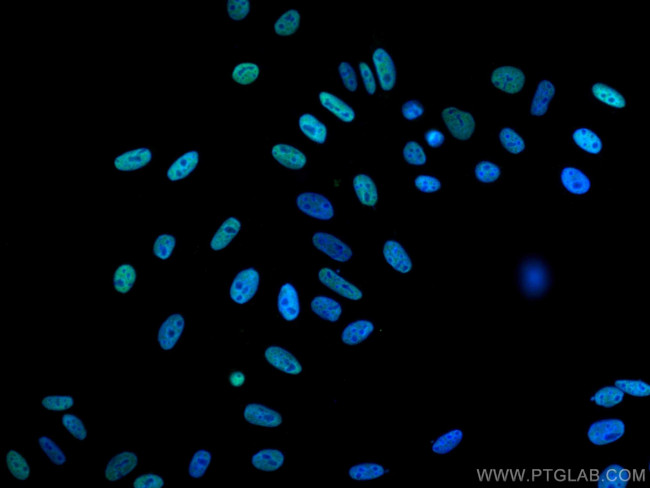 RALYL Antibody in Immunocytochemistry (ICC/IF)