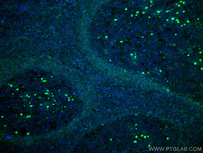 IgD Antibody in Immunohistochemistry (Paraffin) (IHC (P))