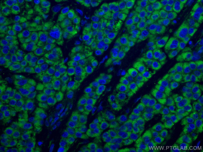 SDHB Antibody in Immunohistochemistry (Paraffin) (IHC (P))
