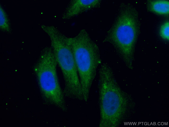 Ch-TOG Antibody in Immunocytochemistry (ICC/IF)
