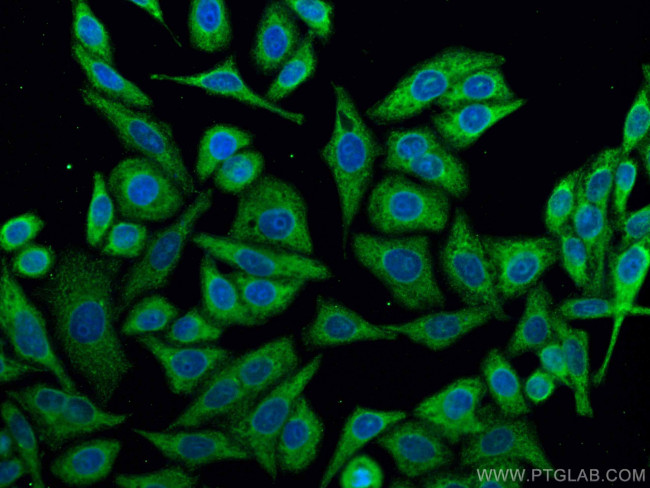 RPS12 Antibody in Immunocytochemistry (ICC/IF)
