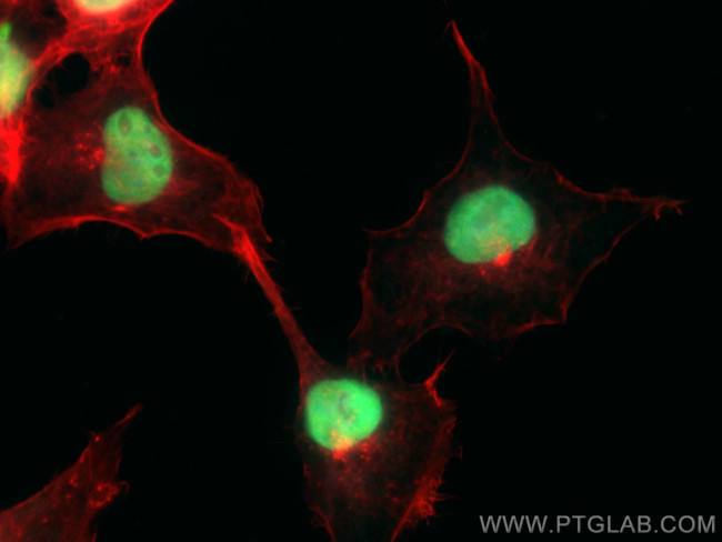 ANP32A Antibody in Immunocytochemistry (ICC/IF)