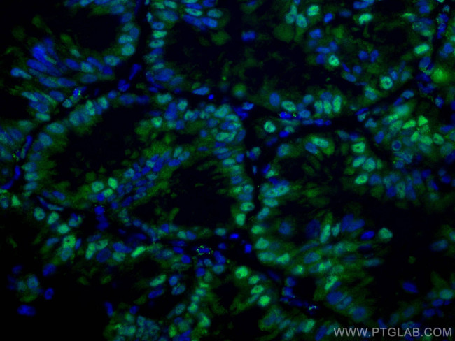 PSMA6 Antibody in Immunohistochemistry (Paraffin) (IHC (P))