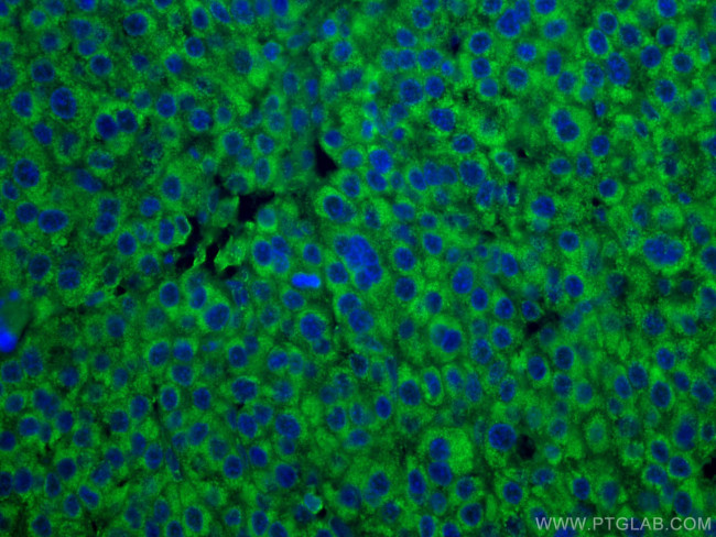 DLD Antibody in Immunohistochemistry (Paraffin) (IHC (P))