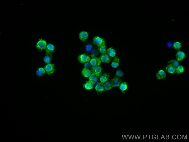 ITK Antibody in Immunocytochemistry (ICC/IF)