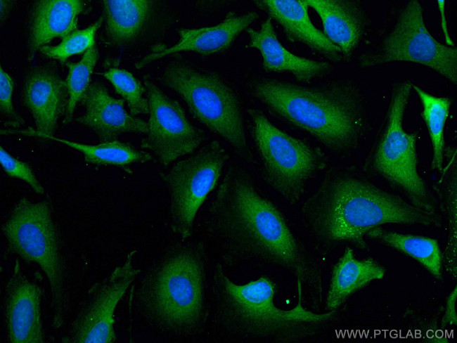 TXNRD1 Antibody in Immunocytochemistry (ICC/IF)