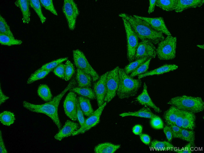 RPL6 Antibody in Immunocytochemistry (ICC/IF)