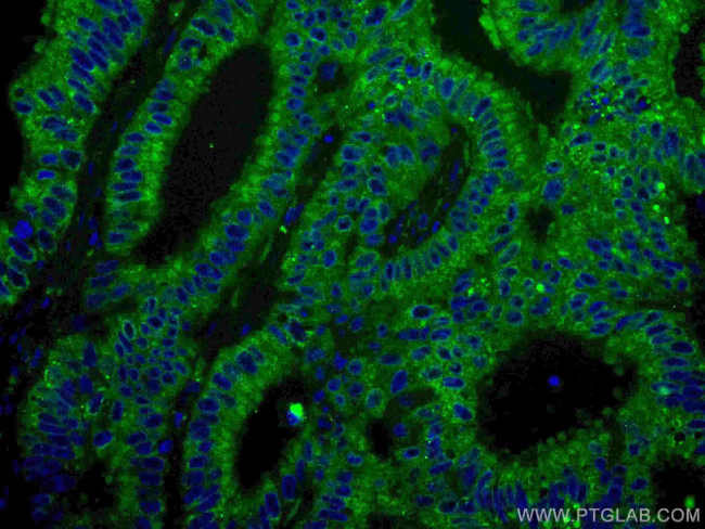 ING4 Antibody in Immunohistochemistry (Paraffin) (IHC (P))