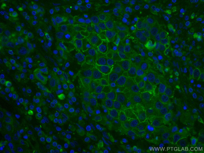 ALCAM Antibody in Immunohistochemistry (Paraffin) (IHC (P))