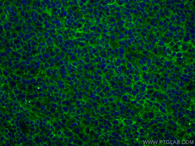 NT5E, CD73 Antibody in Immunohistochemistry (Paraffin) (IHC (P))