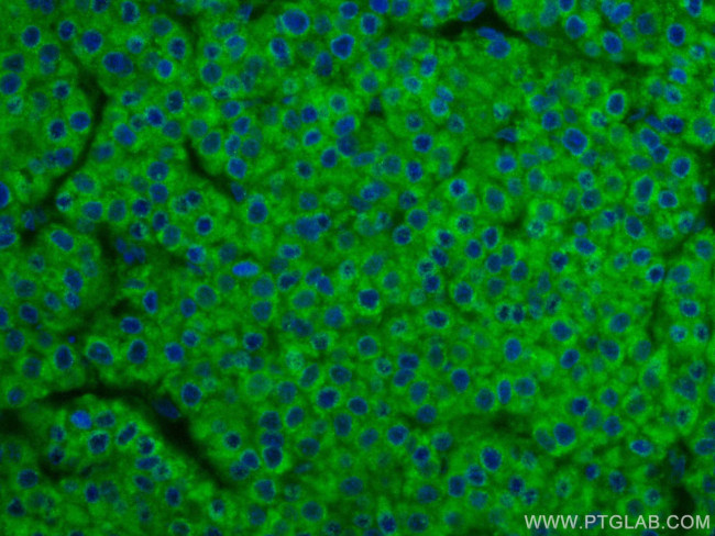 SERBP1 Antibody in Immunohistochemistry (Paraffin) (IHC (P))