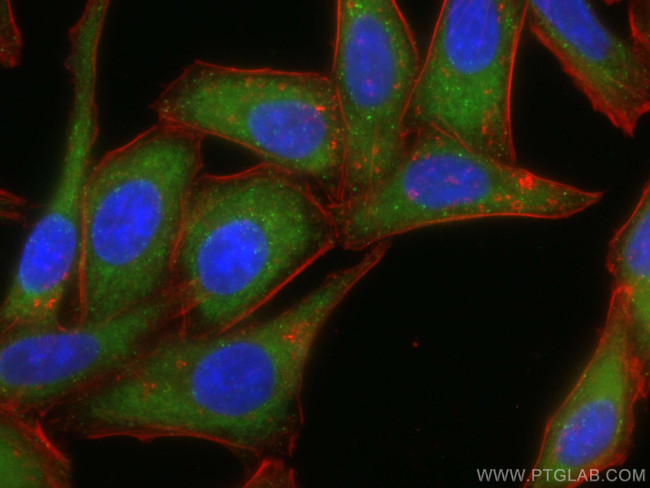 HGS Antibody in Immunocytochemistry (ICC/IF)