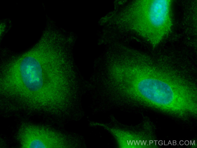 RCHY1 Antibody in Immunocytochemistry (ICC/IF)