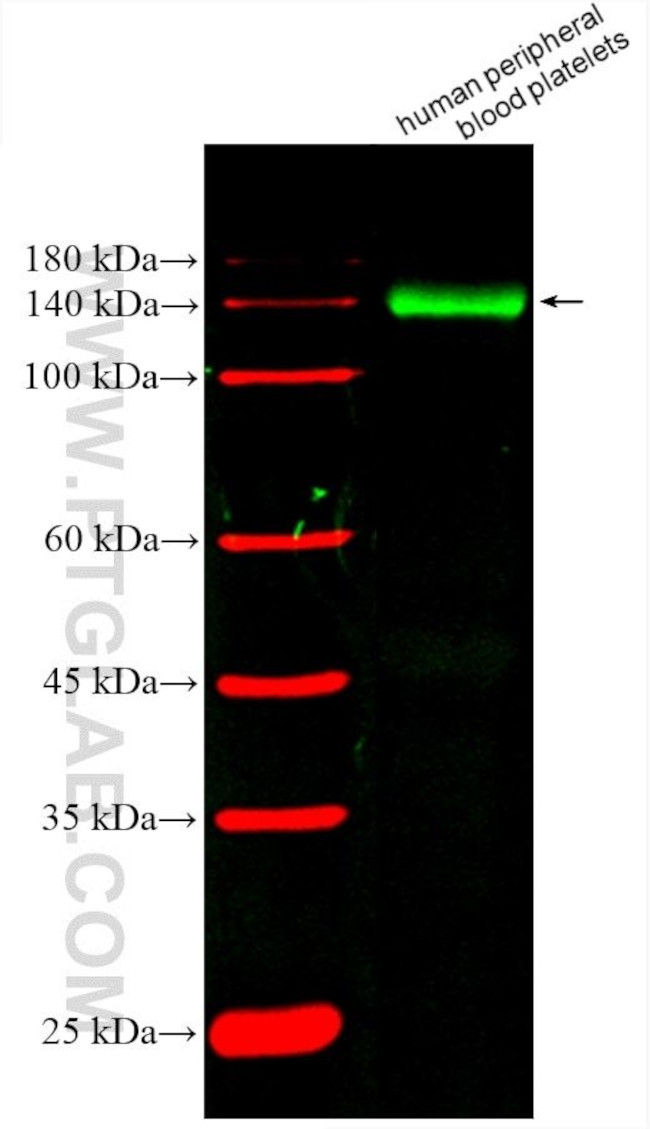 GP1BA Antibody in Western Blot (WB)