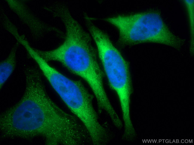 DARS Antibody in Immunocytochemistry (ICC/IF)
