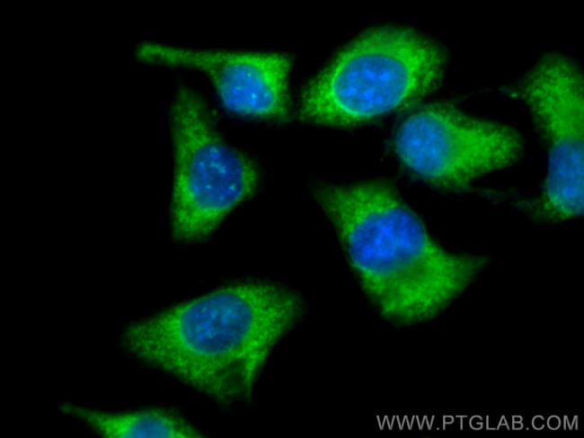 PTPN9 Antibody in Immunocytochemistry (ICC/IF)
