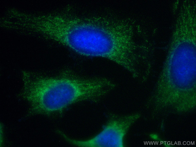 C1QBP Antibody in Immunocytochemistry (ICC/IF)