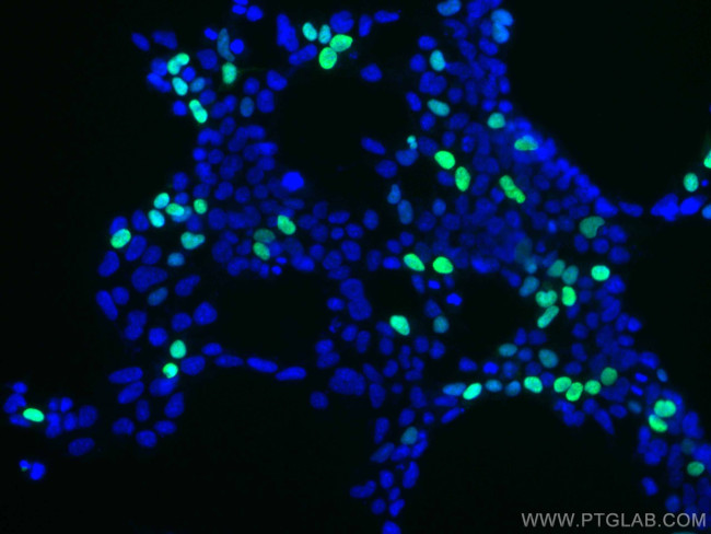 DYKDDDDK tag Antibody in Immunocytochemistry (ICC/IF)