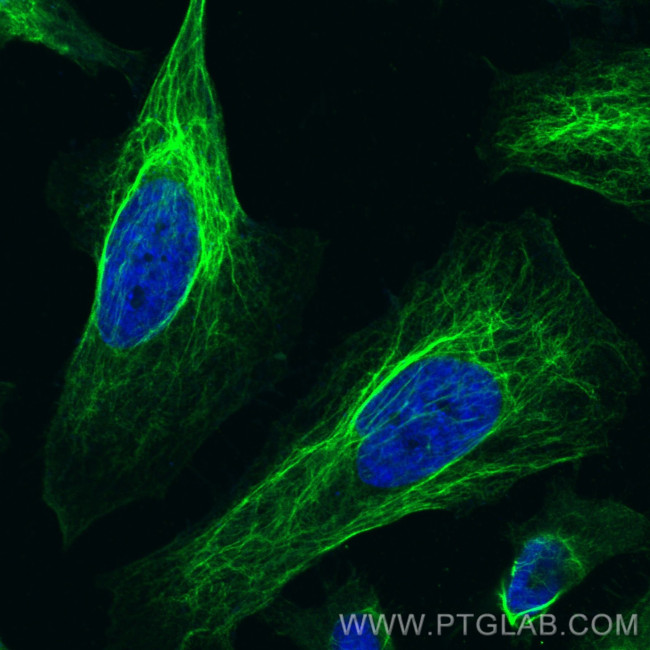Vimentin Antibody in Immunocytochemistry (ICC/IF)