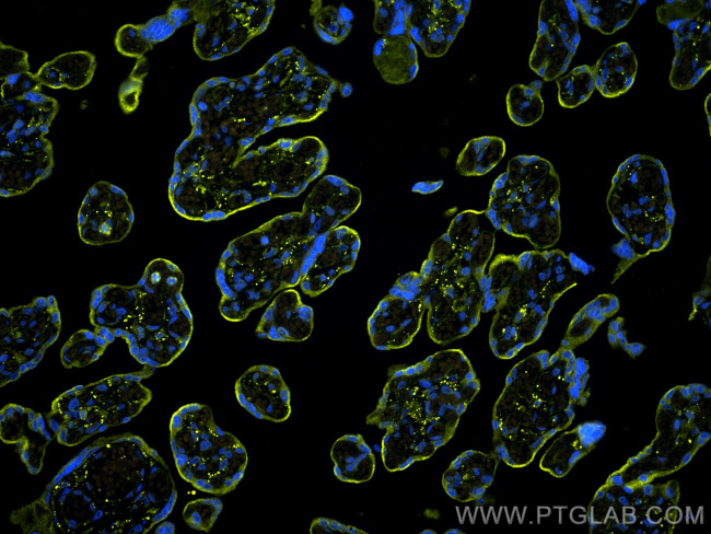 VISTA Antibody in Immunohistochemistry (Paraffin) (IHC (P))