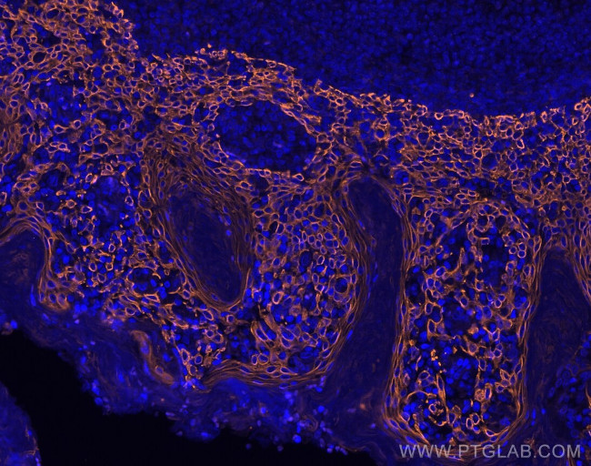 TIM3 Antibody in Immunohistochemistry (Paraffin) (IHC (P))