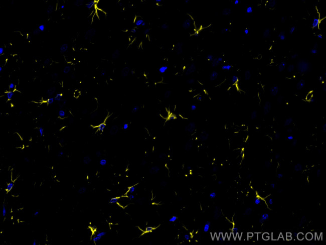 GFAP Antibody in Immunohistochemistry (Paraffin) (IHC (P))