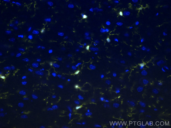 IBA1 Antibody in Immunohistochemistry (Paraffin) (IHC (P))