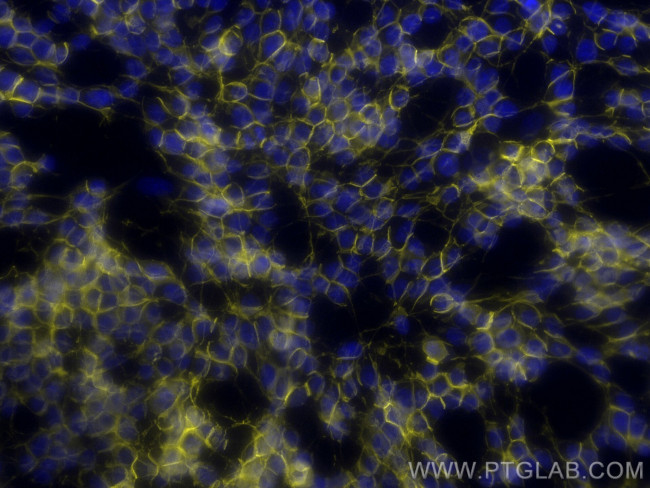 NCAM1/CD56 Antibody in Immunocytochemistry (ICC/IF)