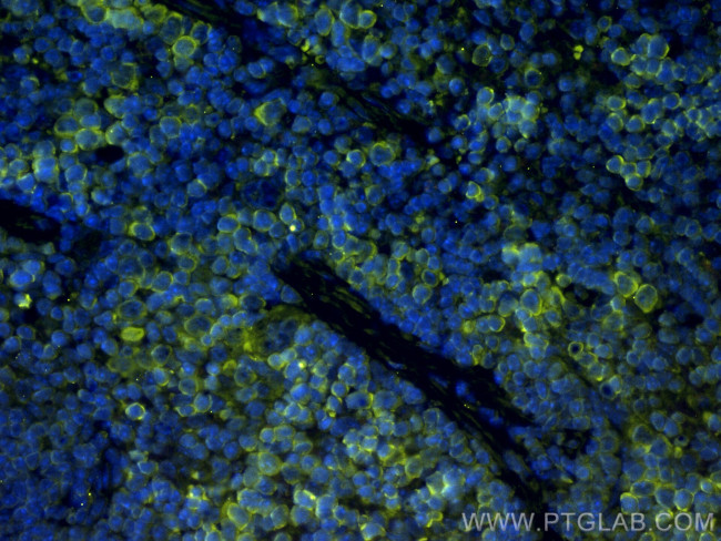 TIGIT Antibody in Immunohistochemistry (Paraffin) (IHC (P))