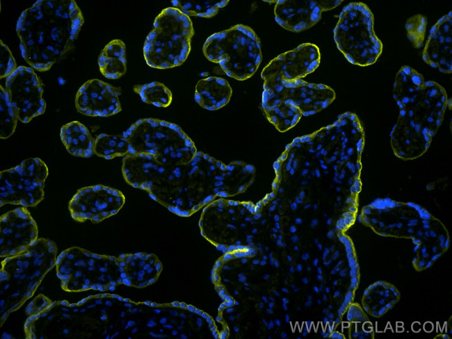 VISTA Antibody in Immunohistochemistry (Paraffin) (IHC (P))