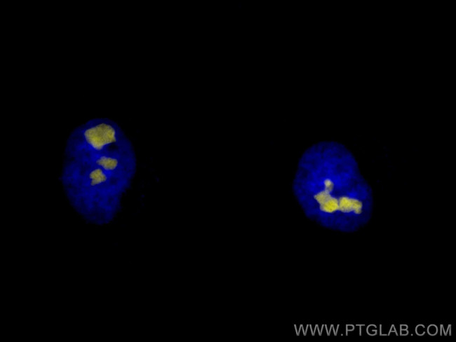 B23/NPM1 Antibody in Immunocytochemistry (ICC/IF)