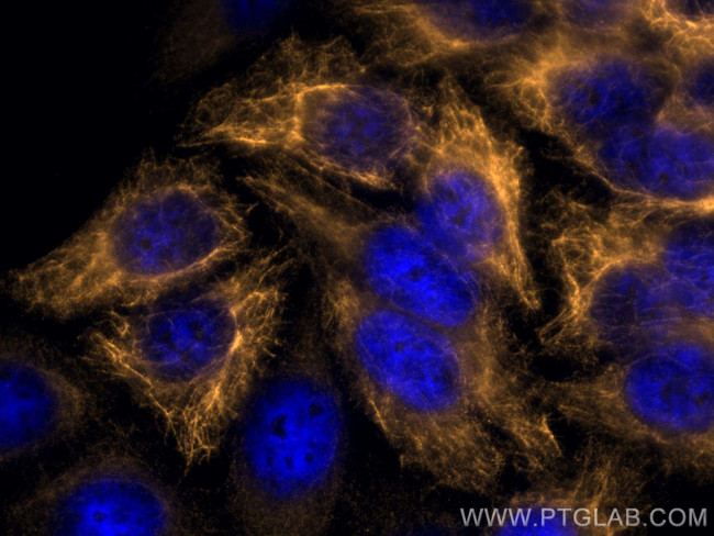Cytokeratin 14 Antibody in Immunocytochemistry (ICC/IF)